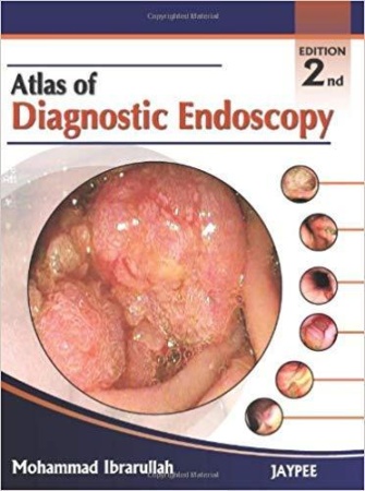 atlas of diagnostic endoscopy (mohammad ibrarullah)